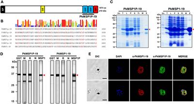 Merozoite surface protein 1 paralog is involved in the human erythrocyte invasion of a zoonotic malaria, Plasmodium knowlesi